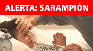 Alerta: Sarampi&oacute;n