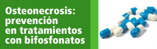 Osteonecrosis:prevenció en tratamientos con bifosfonatos