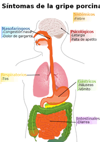 Síntomas de la gripe porcina